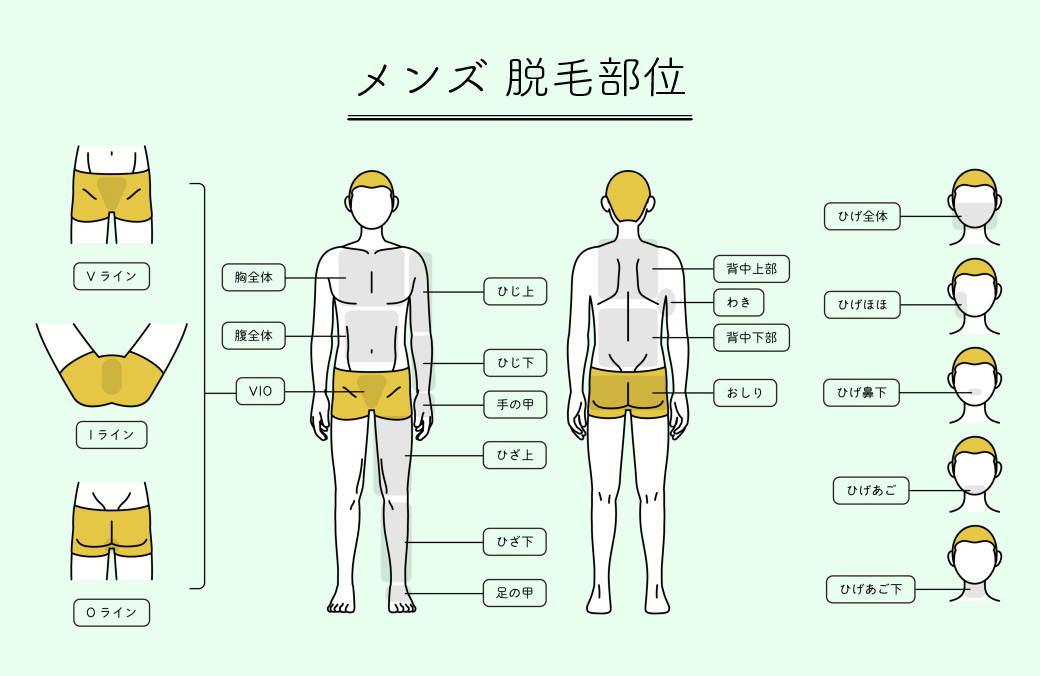 脱毛